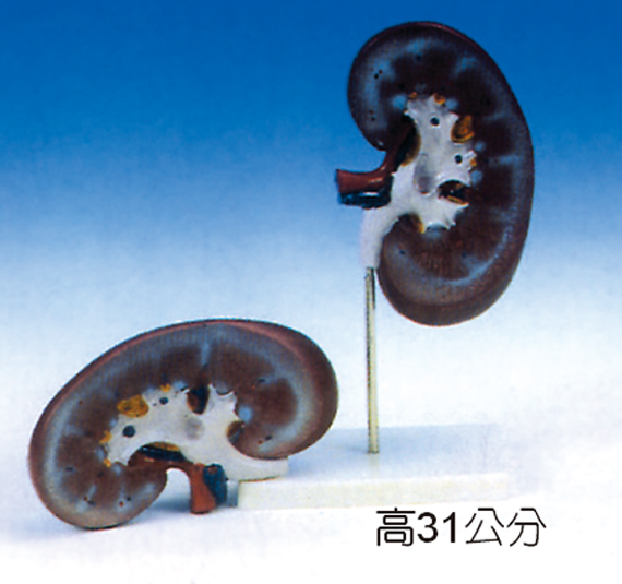 胃模型